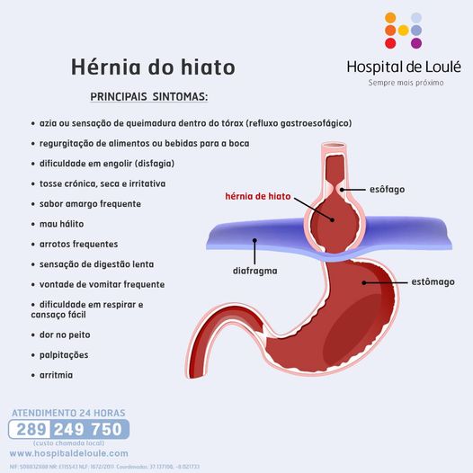 Have you ever heard of hiatal hernia?