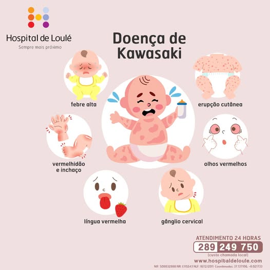 Kawasaki disease