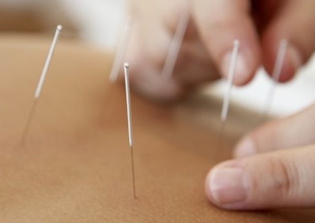 Traditional Chinese medicine